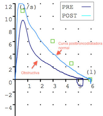 Curva FV Obstructiva