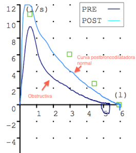 Curva FV Obstructiva